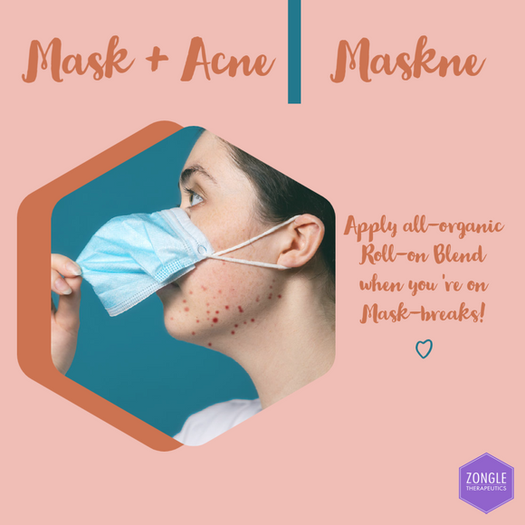 Are Face Masks Giving You Acne? Try Out This Roller Blend