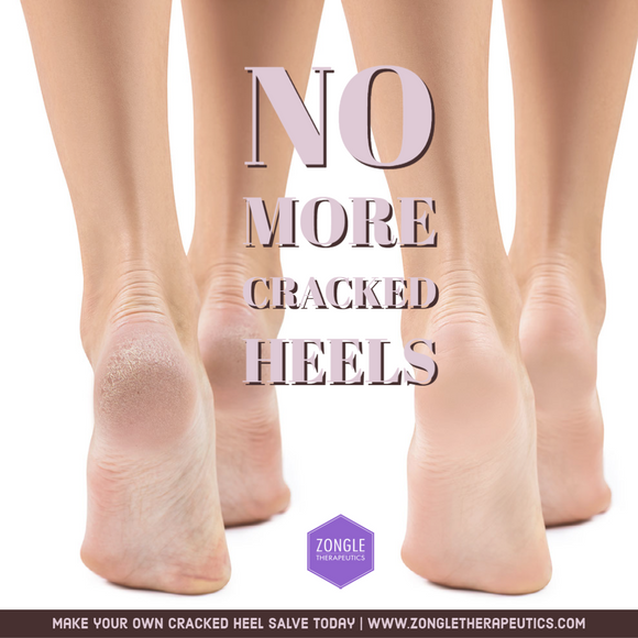 No More Cracked Heels