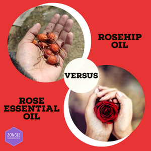 Rosehip Oil Vs. Rose Essential Oil